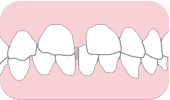 前歯の歯と歯の間が空いている。